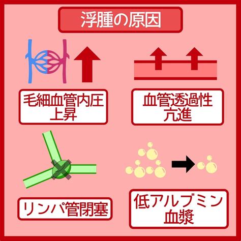 浮腫病|【浮腫とは？】浮腫の原因、メカニズム、治療・ケア。